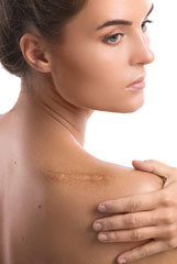 Unwanted Scars & Tattoos Unwanted Scars & Tattoos