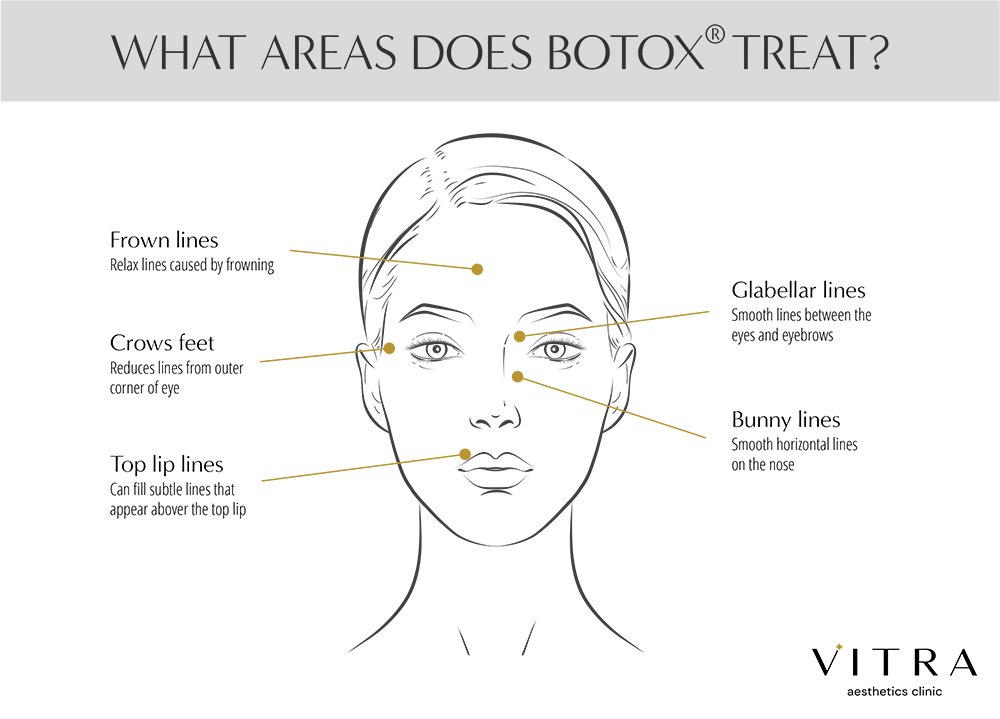 See what’s possible with BOTOX® at Long Island’s VITRA Aesthetics Clinic.