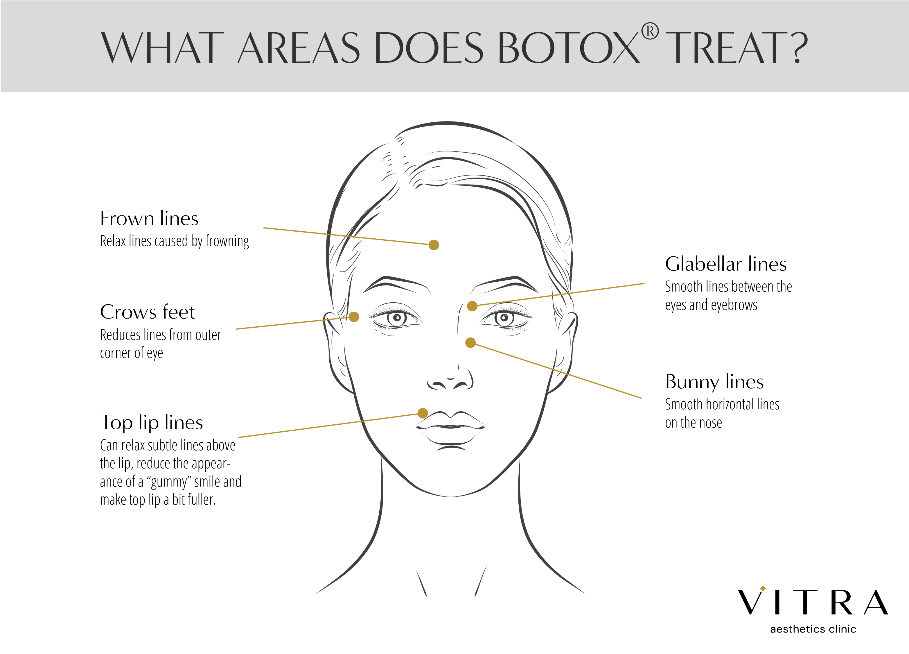 See what’s possible with BOTOX® at Long Island’s VITRA Aesthetics Clinic.