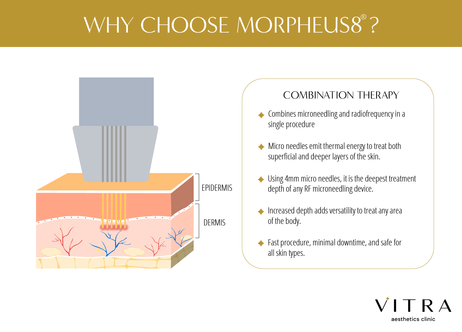 Learn what powers Morpheus8 RF microneedling at Long Island’s VITRA Aesthetics.