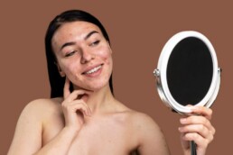 will hyaluronic acid help with acne